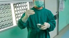 疑用井水刷牙致寄生虫入脑 中国男子脑中被取出十厘米活虫